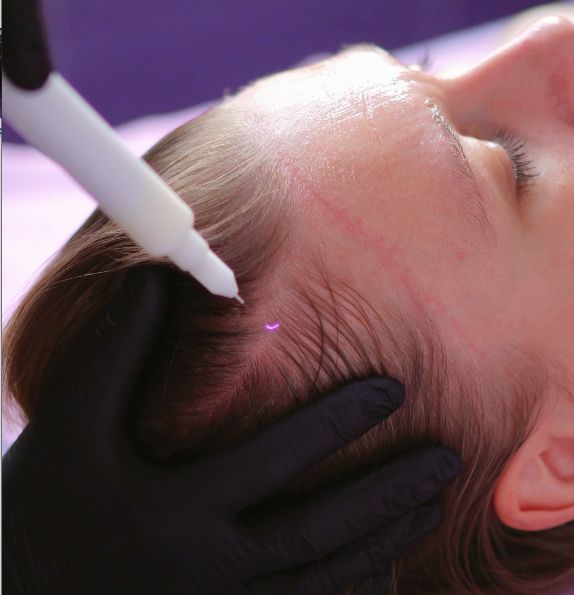 Холодная плазма.jpg